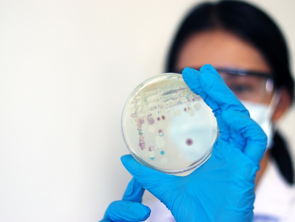 Scientist holds a petri dish with vibrio vulnificus in it