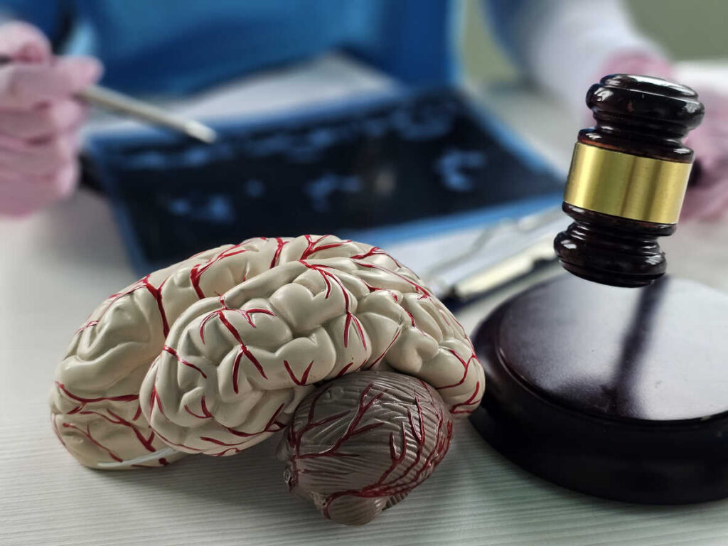 Brain Injury Attorney